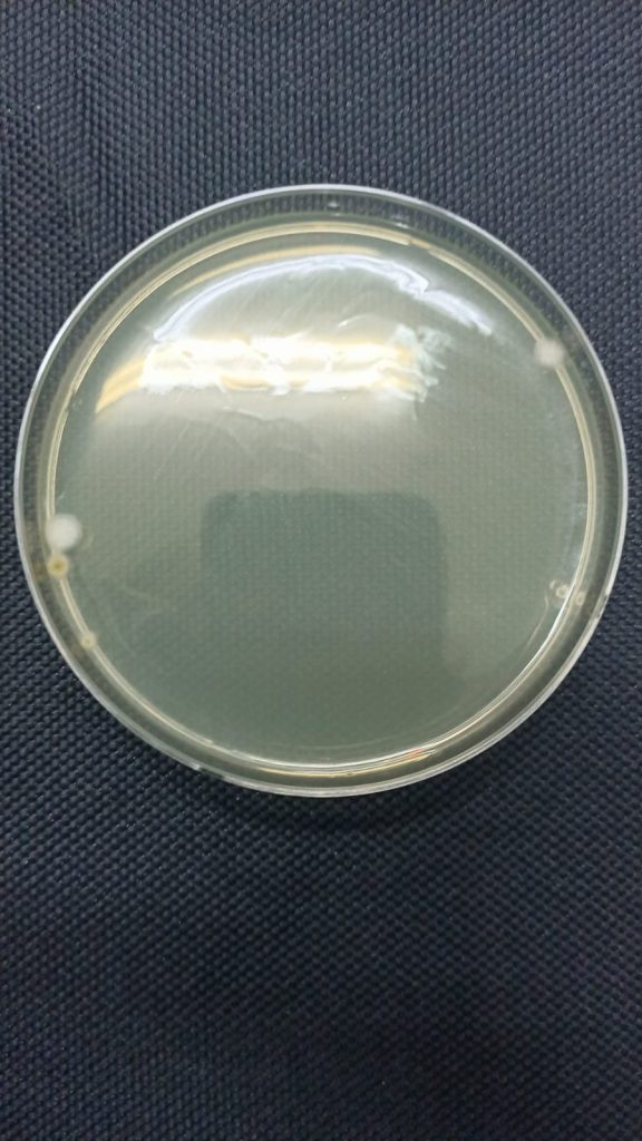 no bacteria growth on the petri dish which were exposed to UVC for 20 minutes