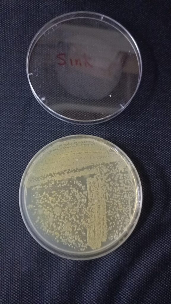 bacteria growth in petri dish from common washing area
